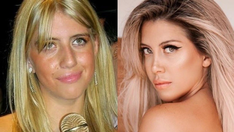 El antes y después de Wanda Nara